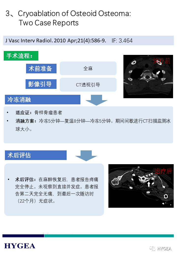 sP1LN6oJsgh8xfzu0OgzIwKVIxidC1ExTUyT4NAV