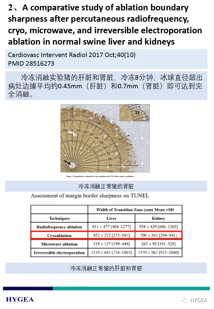 0nB97sRdeuPmND90mZFFNfC4Vvvzob8b4SQeWcF1