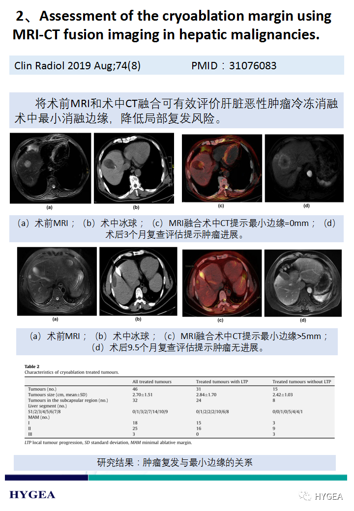 1n3sEIu7G7GxdnLKy3ovxK8Rsk0oyqzDZxDwRaUC