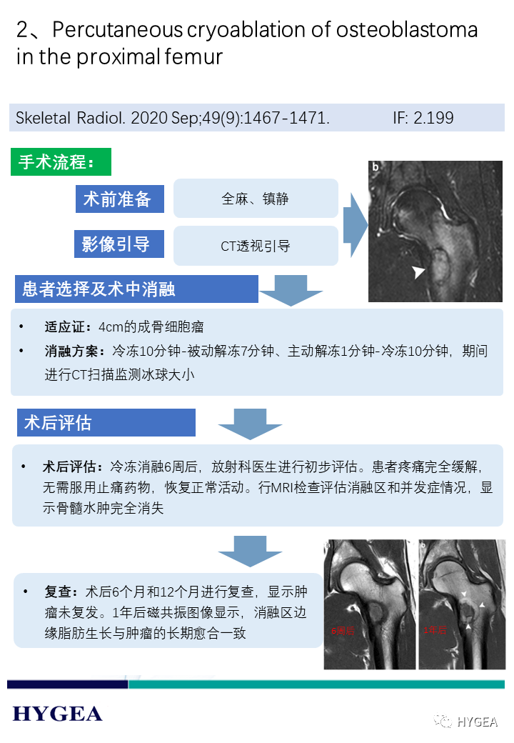 62ApNcUqVIFywfZTut97C9LlMsvV1iNwqRrYxxa6