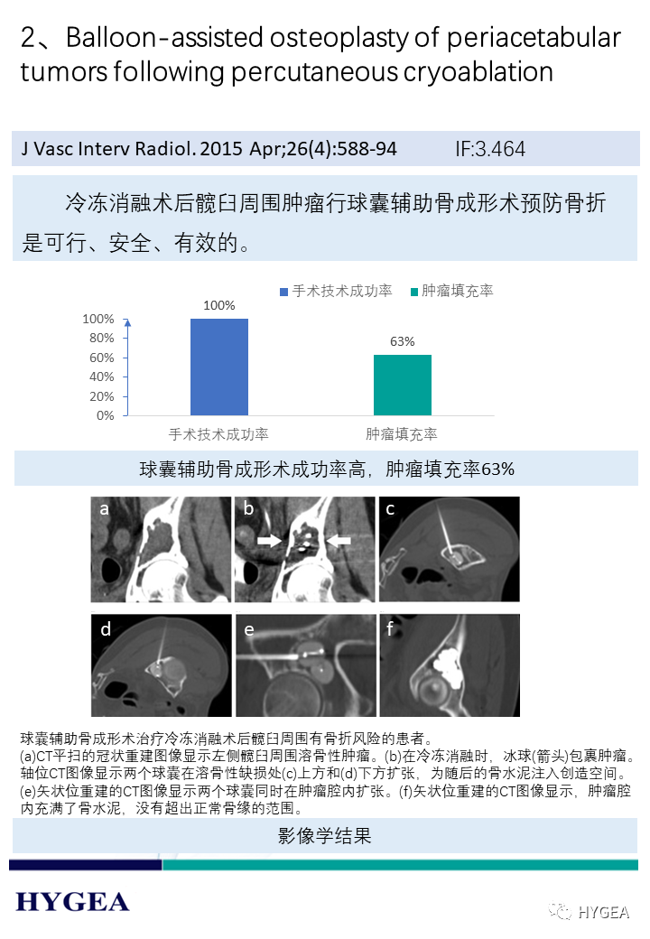 80QklLTREydmGjOmzbKi9Srlap81n0cGVeigFq6B