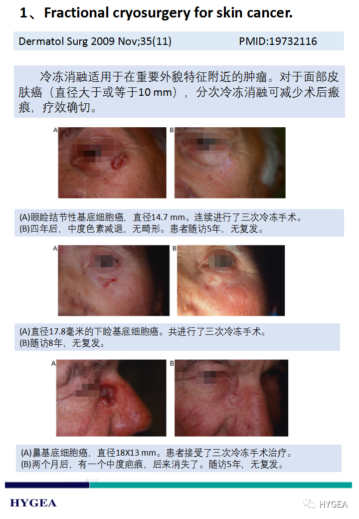 ECU7HRdqvIhLJRm4dzwUR8Sn46yM5OANJnsNJqM9