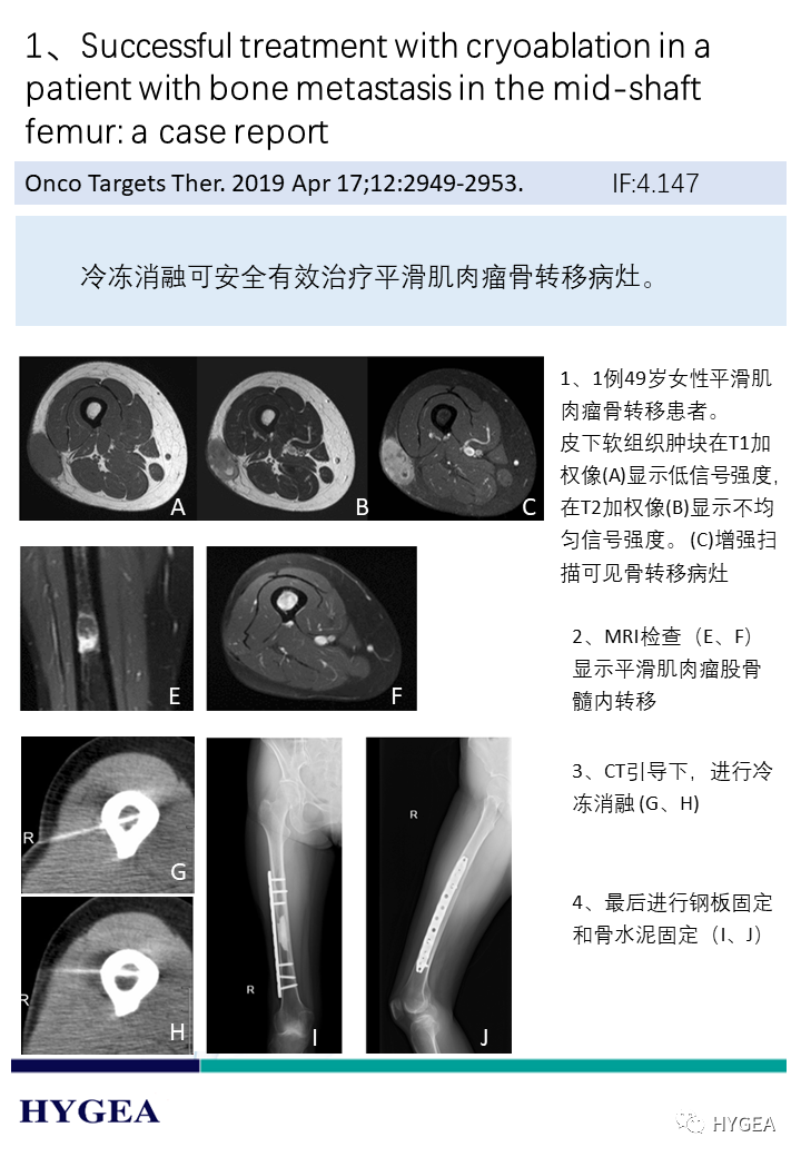 IqKxnEcz95MlpFWwiQ9wHpbF7XeYTWOKXk7wPB7e