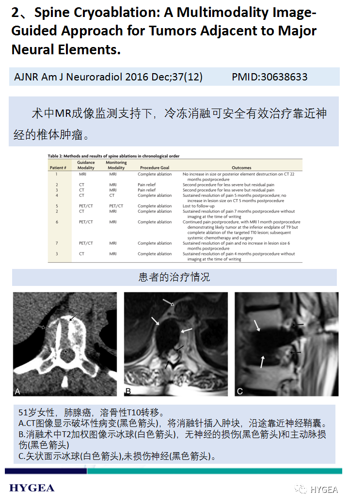 LyEvsXUErtup232AcmdW8cttiA5GxAJPpCTkn2ZE