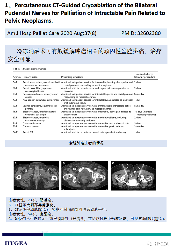 PUJxFQxj9L77AQkywFkApkE5whOjGdPOpycEC1pp