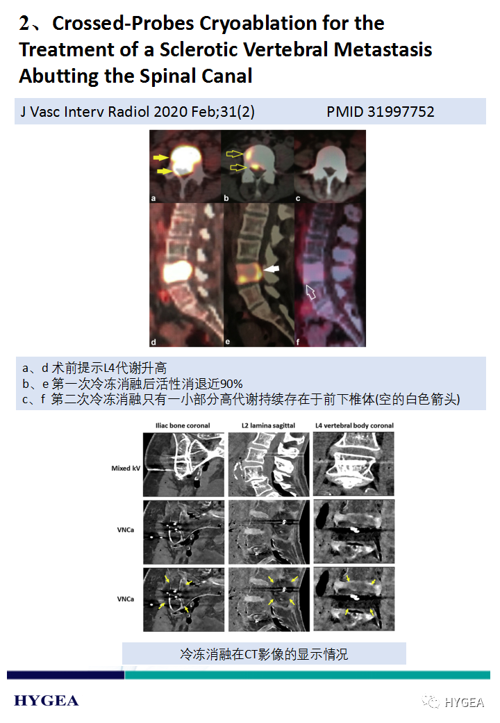 R5jobVpFTojVikTDOixMWI8mmbZA8eoGs6FvAKz4
