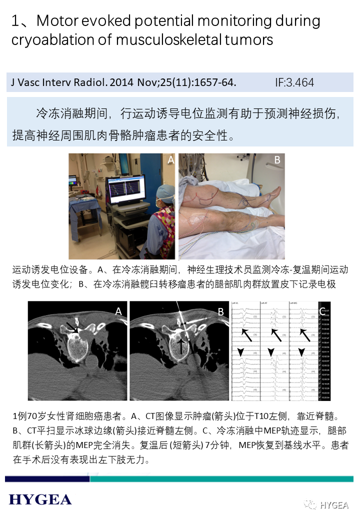 jwZCpOvuN9jLc1N8XQo1AvWJVgyMmAix4UXq8D1v