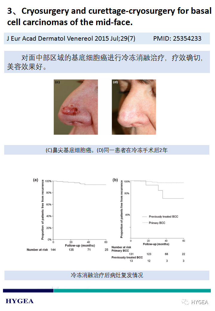rd47QaKe5PkeQmqFtP4oJurVxXcKNo2GVSraajYL