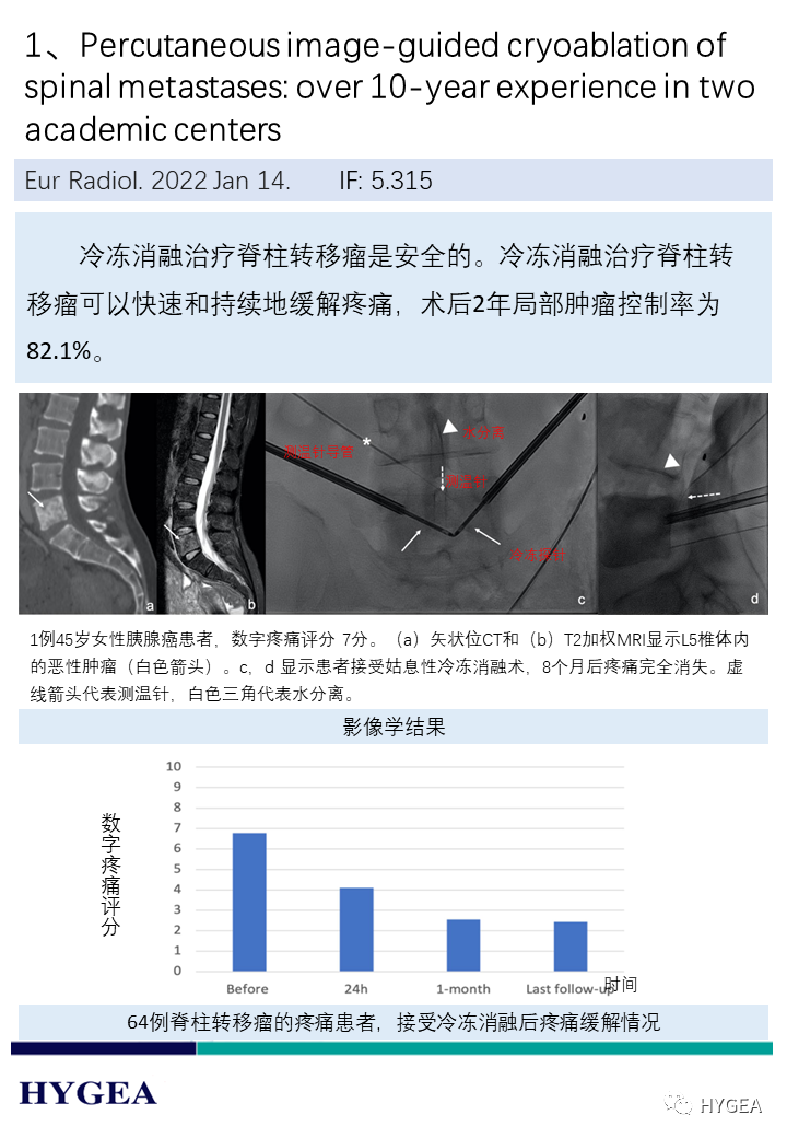 xBZEHkoa2HwAHGVzzZdlXqKJJ6uP7FuWUvRln09x