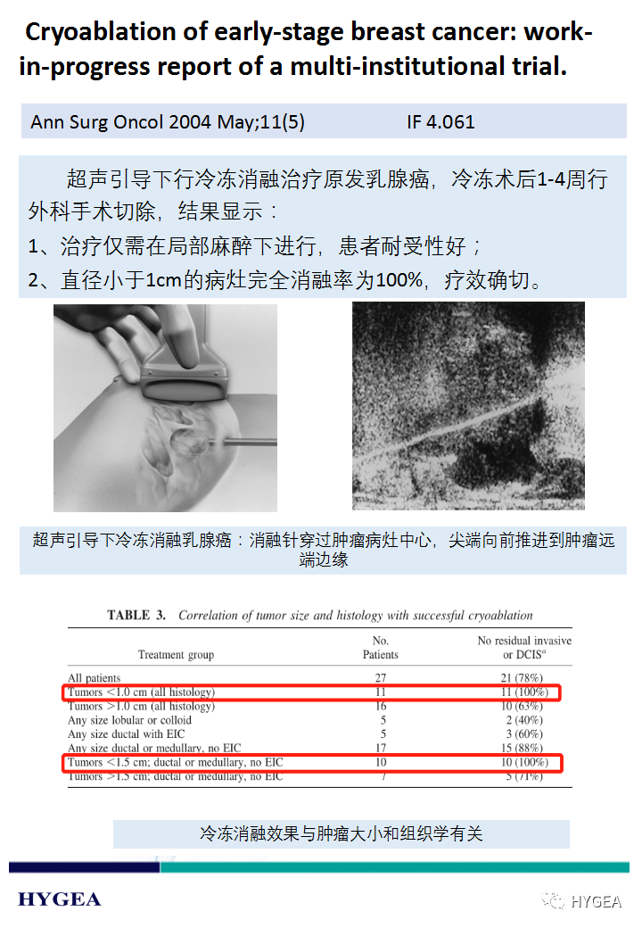 0SfIHhdpDemKpBOMmOkPILdAsXTxk9Pz8ep5jrdx