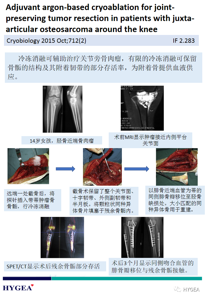 1uO00jpRzlRtOdcvNjinyUkCLNopVxXCI9TFuAvE