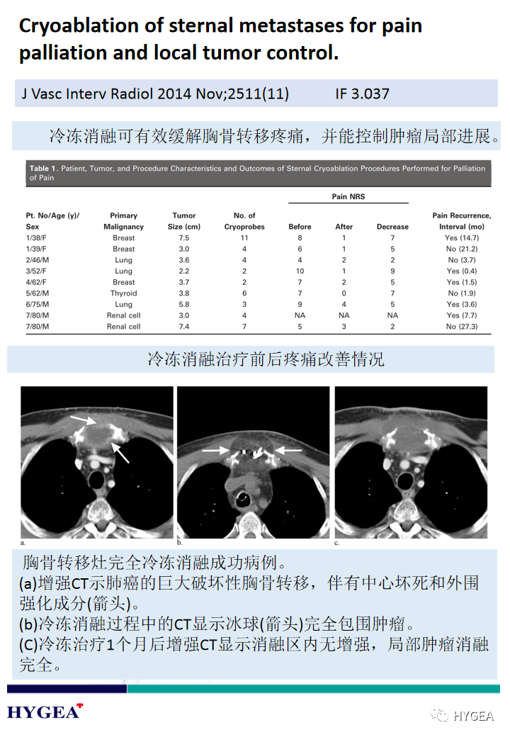 2wjLA58zl2klljYxCsBmMl5Kh1pGykotUE9brN86