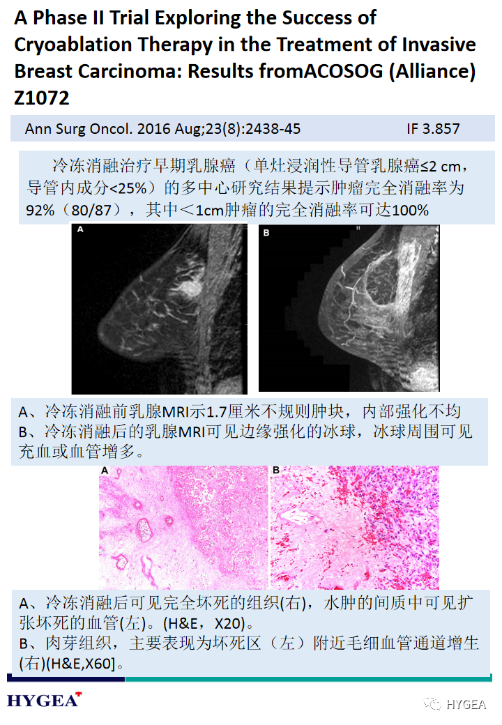 3TL533pIS1JKxW8WrpqMXvpYY7E8qiPGzotkpC2o