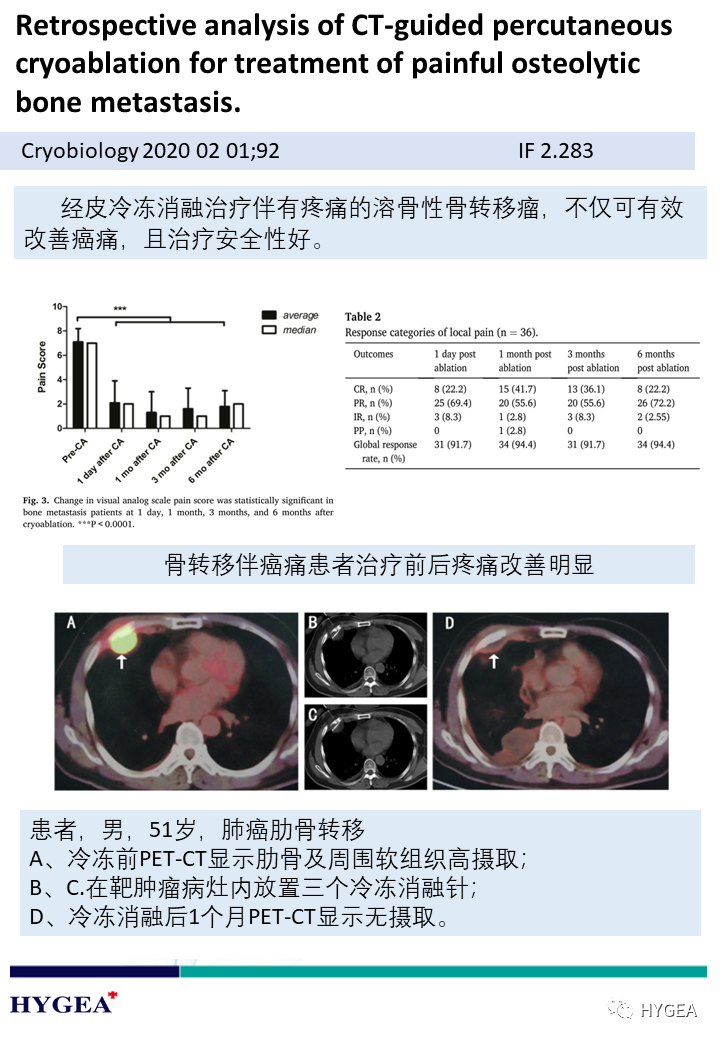 3lvpIJdfBbhORBeKDJEs5EajWAfXt2KNGja5xKOu