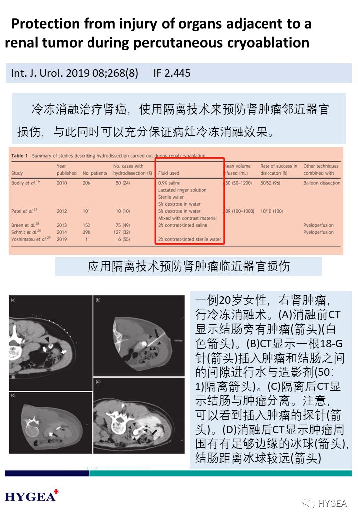 CINBKQLVk1EGwDxc7MAooz2ndLNTA5Fwdxoa0OvR