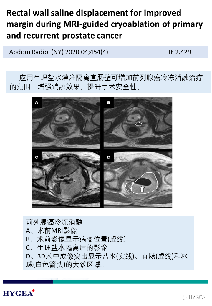 D35UZ5quP1VJI0z5NQXEemKHYvQlVPykOwaanieM