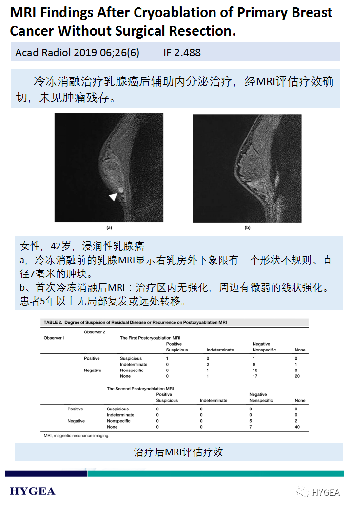 IRpcXnxT4SdbOgIA5SrgPjkhRvFfRJWVTtnJqWtE