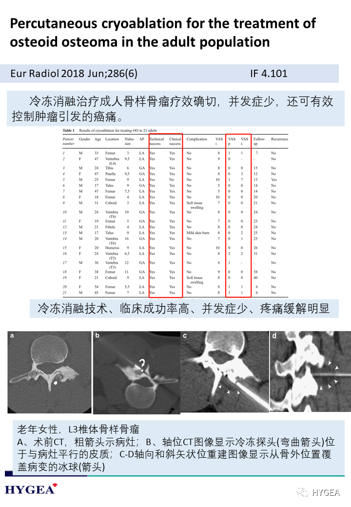 KkCM324BMVfvnzrp9l9xi9OiZXhFFwSYqJ23ofzd