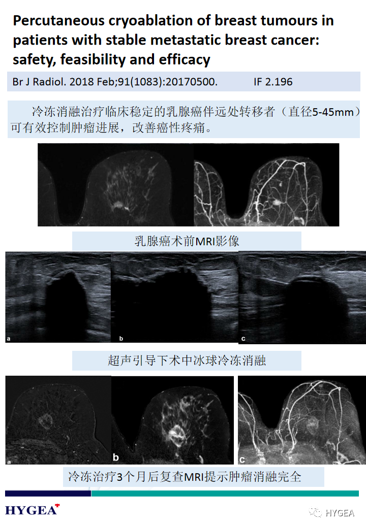 LWCxJ6zzTzMV7OzUBacsOId9qdRRJzXiTKlqn6FL