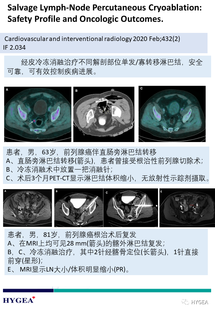 UBf7kCxkj6I00MdFvu17t5LQZwNc8ScXJDZKyxTU