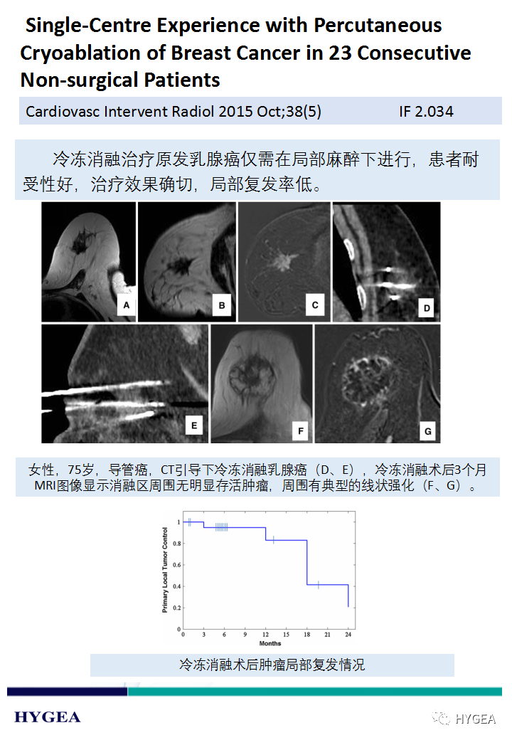 ZzcpBPiWK2CAJwCHu8DRHMRaULis0m33YEC4D4xP