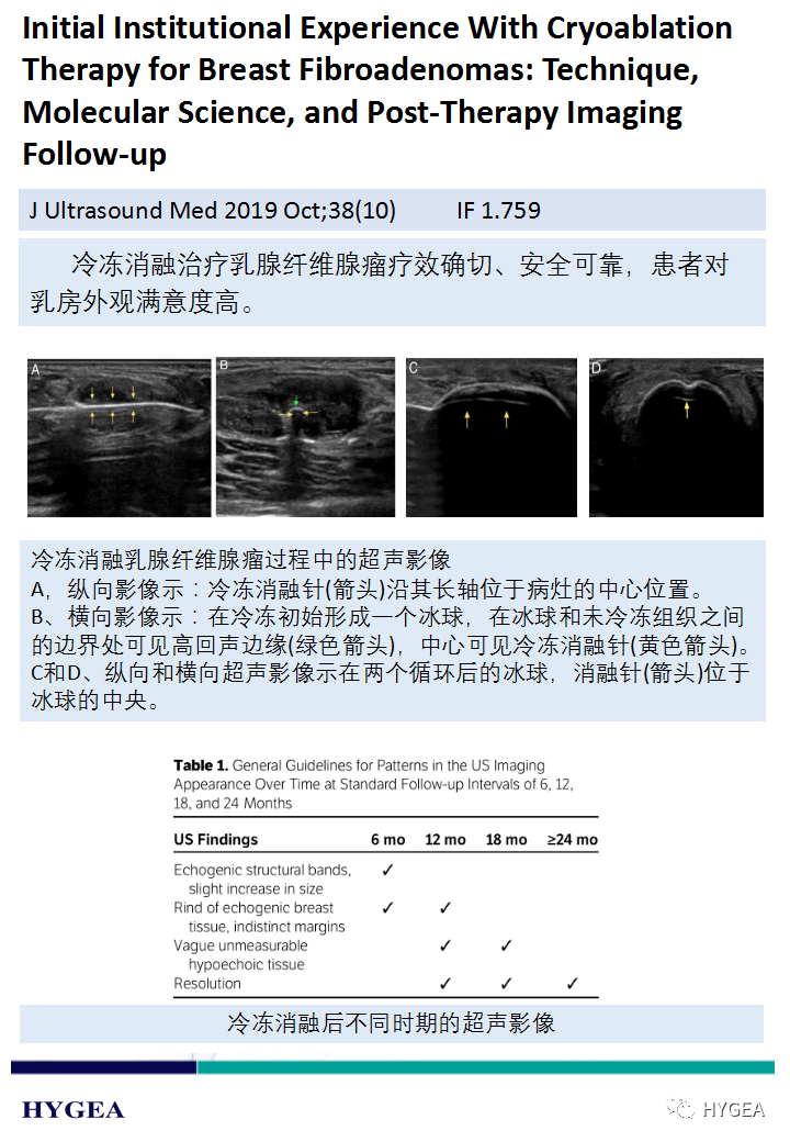 a07j0cvuyxaun6Hn7EQ1TizbMQ1z5cZ0V6FOVZAC