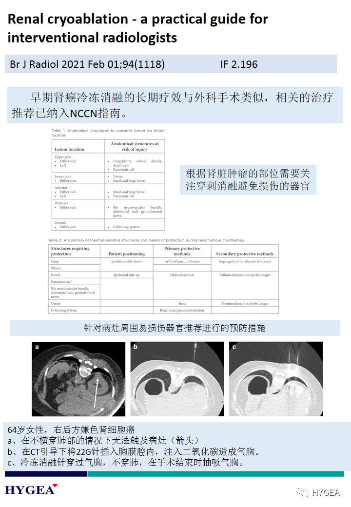 iRex5qXcBtALEYnllXaDmyhyEPMcoo6ftYTNvXil