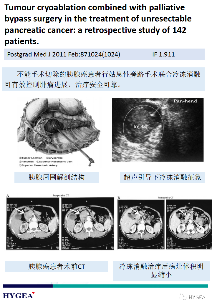 k0kyEAxrAuEKckbdtApsw9XN5e00VpMUs4ffZ4VP