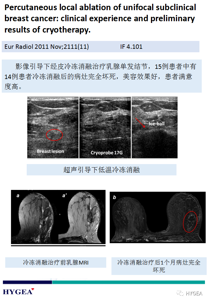 kgGNTQnmuGHEOp5oXfIpl6TLyODdClvr8JtXUNy7