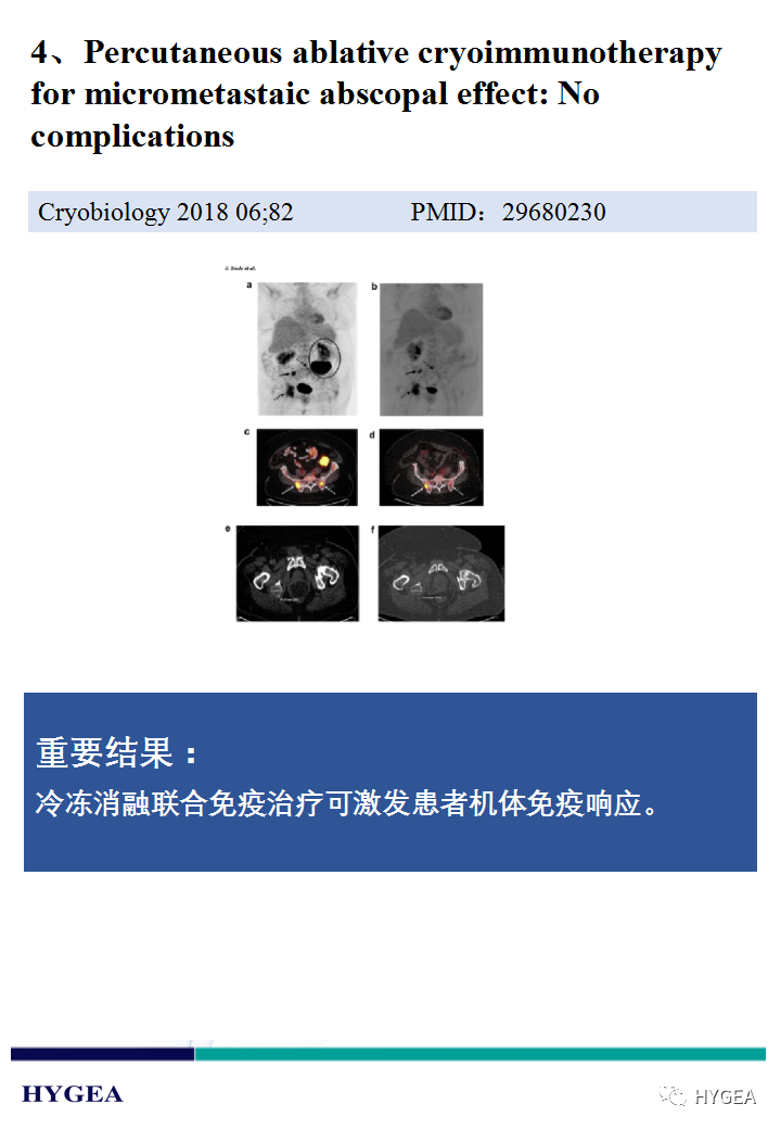 oh7K28jYPyfzAlSQIjZl5OxMPipKsujAVmc26GBR