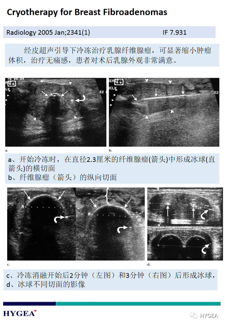 qjjMLg8mfJ9LMblclNA6N8E23a8wvGlRRRqUKSS9