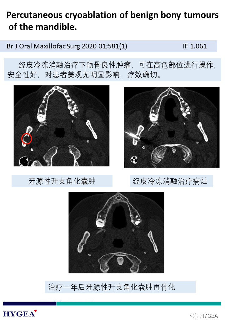 z2wHgN6TNyx9VjgLnOpMuotE6VYZNj372p2VBflx