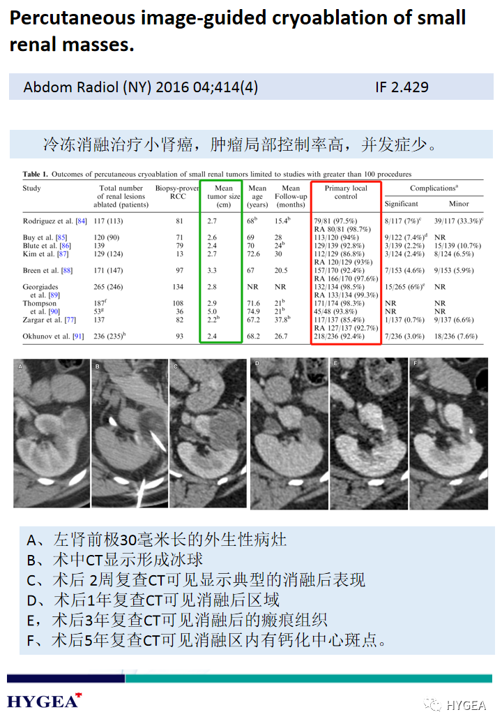 z7GXa5cOOVuQn3nbhoPOZOpXb3rNU6aiHzBfkYLt