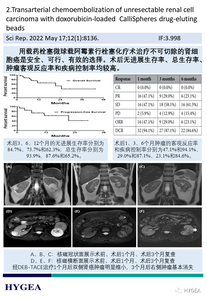 iq2Swa4YlIH8E1i9JNLU6lQ4SxhLxqqGhwkVCB8S