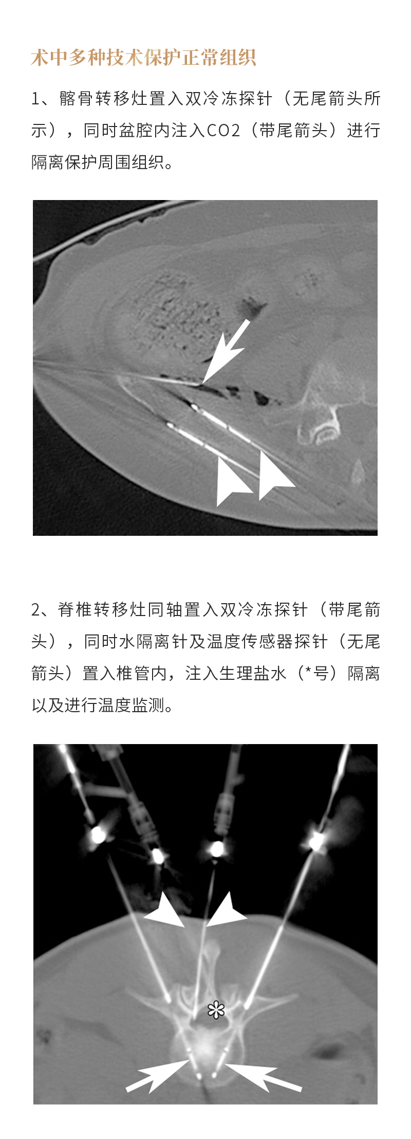 VGkih4aq9m8DkZqlV1eC6e45WtbxKRCrTMhHm9pi