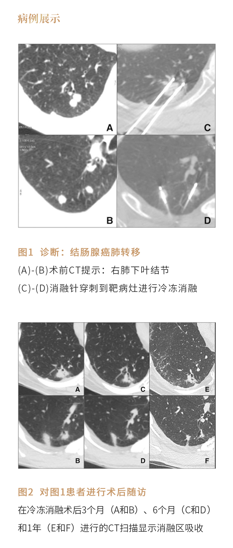 159SMMXjAaMX78pEQPBztwdQJToTtEt5C21t3s3G