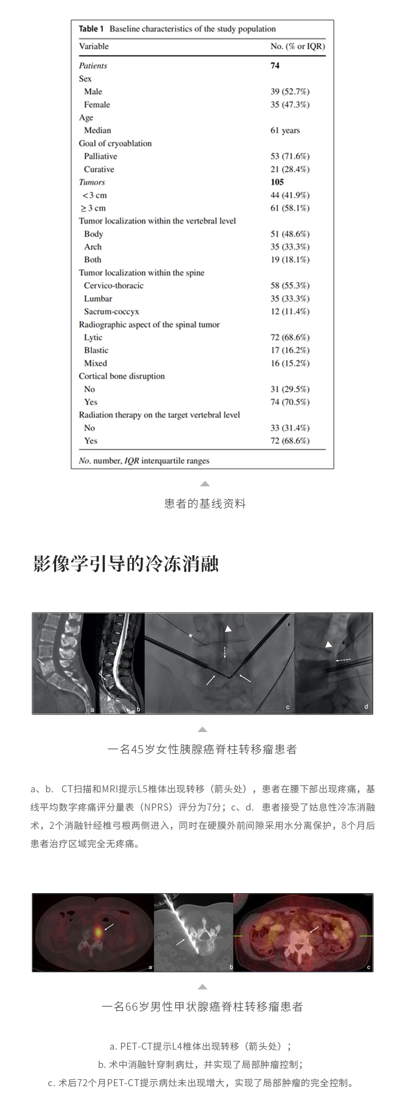 jQIAq38oDitmF68xzWpersI7tiYjByD3f0fpuCi7