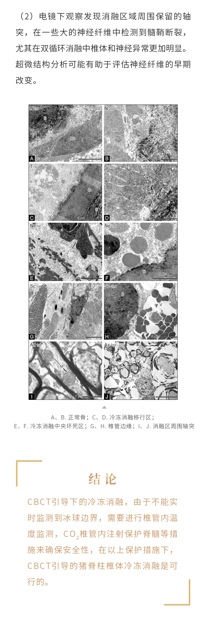 jNEB9wAYCsW9I8AGuimirqgX6lJvvORjH5Tic3WP