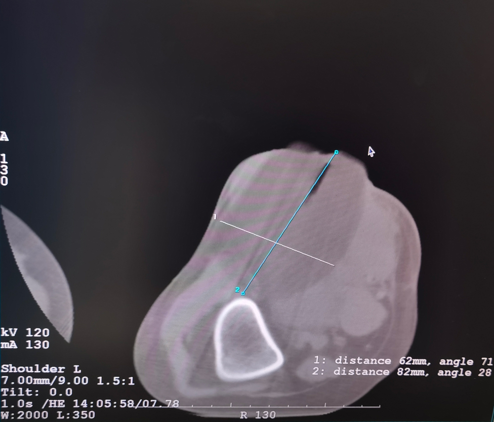 Q9jbl38naYFYtMfSAFcgtvfrLEAkvegEUBGdfyee