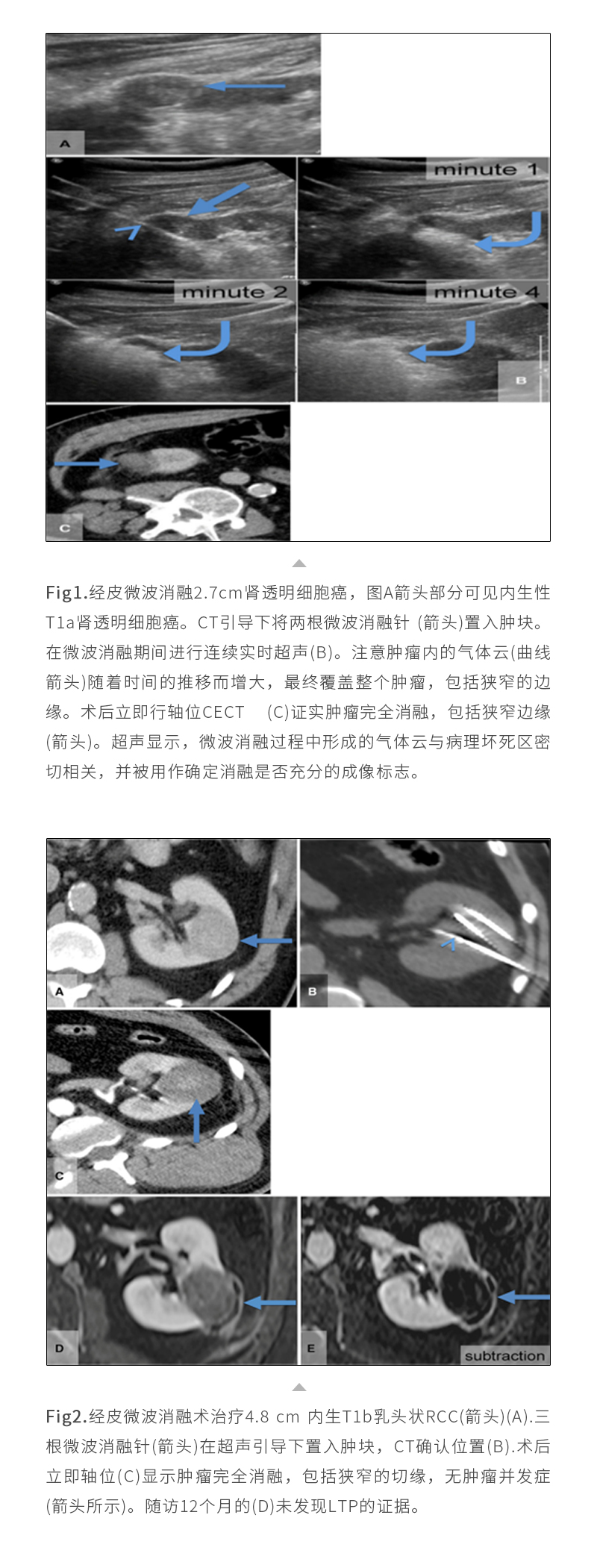 noxzB60UnyyVN1djNM5W7IIMF77otmvJq3Za13Xe