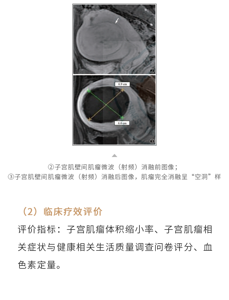 ZXTGzo9QKjluY2BnA1xN32x42oOo12DPPajNoygK