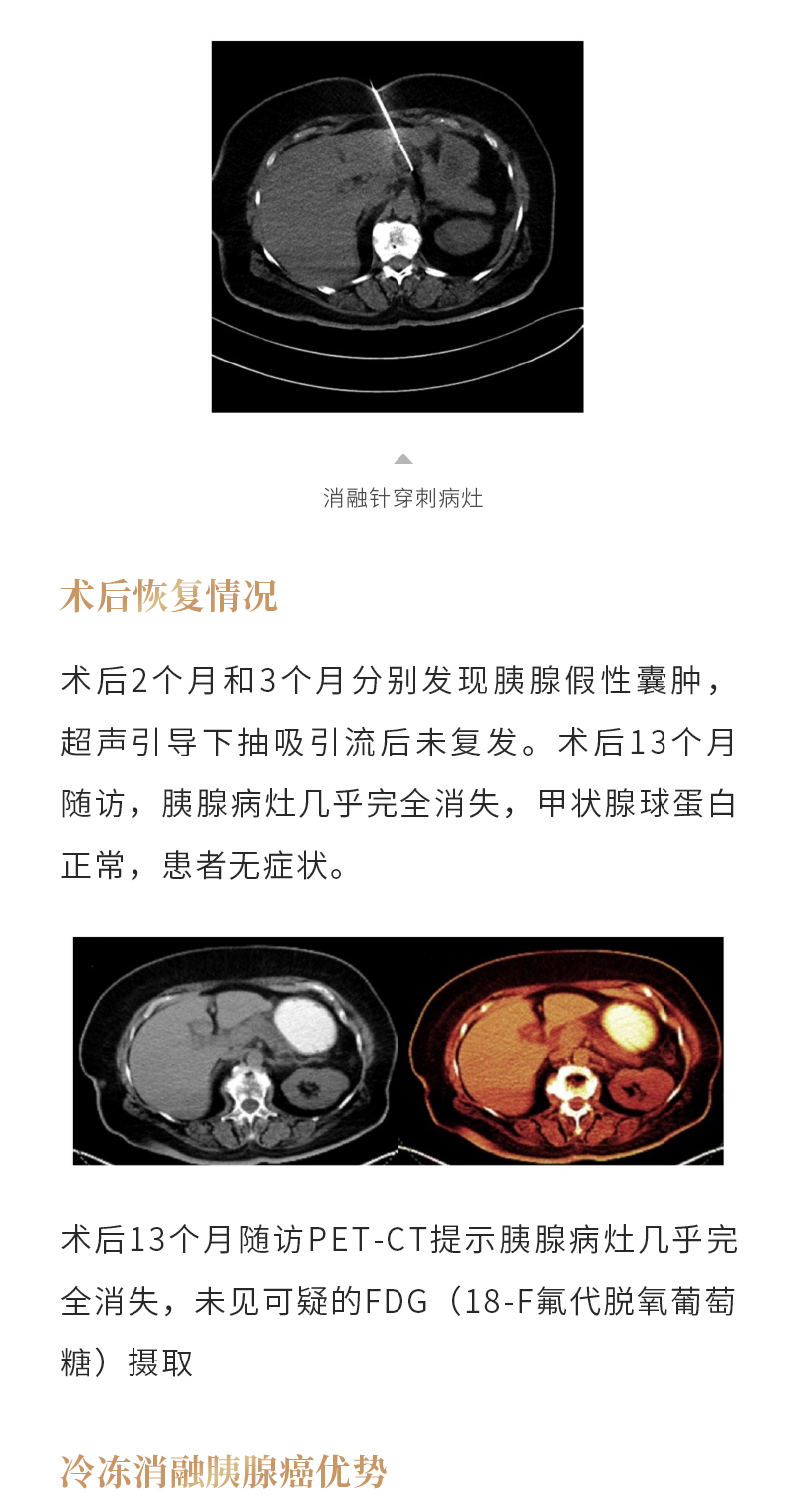 edH2sCU5hlCgxFUFCrlITbzbHUYyBEQd4DFEJbZX