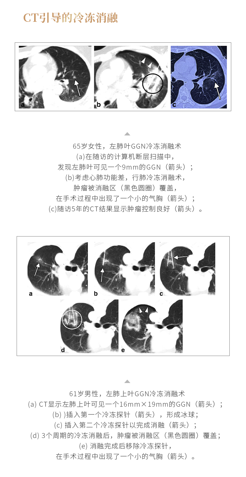 AVof3jvGMVtcbiyNiEgnfTJiqjLwL3eIN2gRb0oX