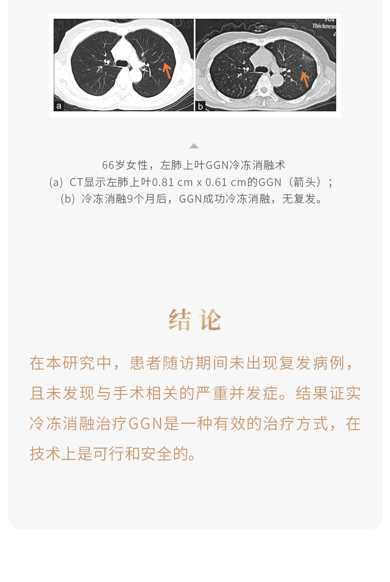 hoZfN1WPBHMi1AfimY44x65GqAjq0LVxHerNZomg