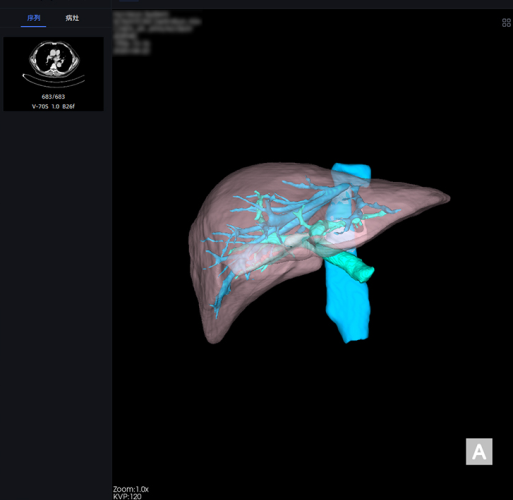 tk41LK91U67HIwyzNCrRRUPmqCRJW8JKI2twDK0Y