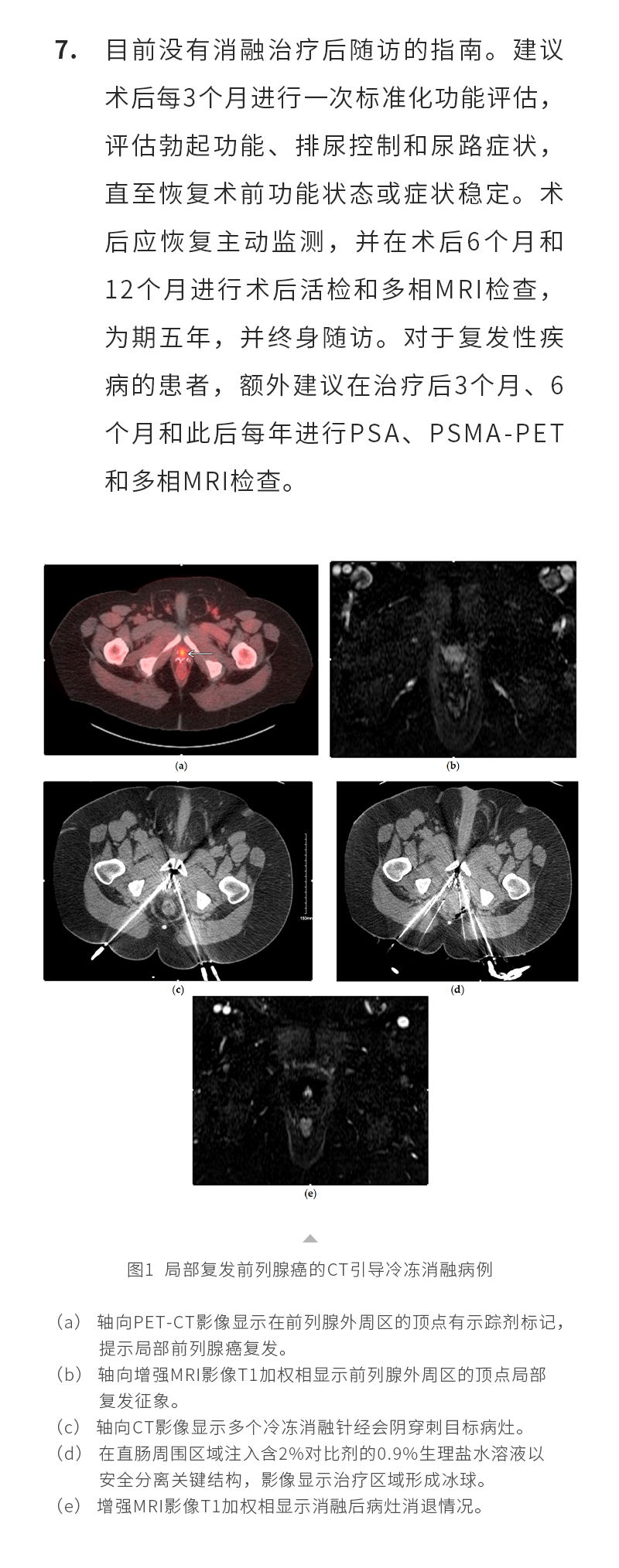 dQN4Uz8o885zJPHjidAcH14LcIRD8uFVzqPCAFoc