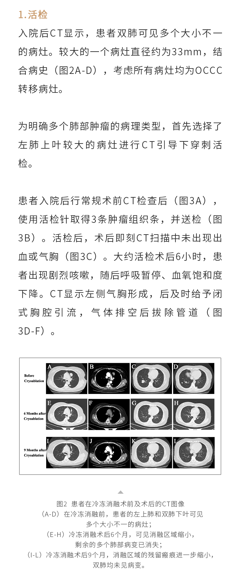 9UCvt1TzDcQpsDDkB4vC4RYmLZLJyU4TQkWbygkq