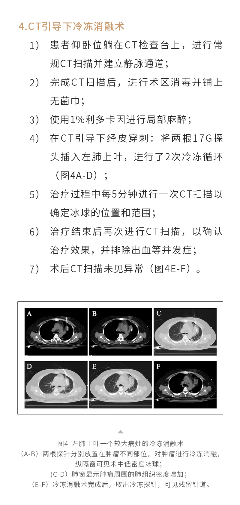UsUNseMEzf7Zy7WBmexENW4sA682bCFj5YHFxW5c