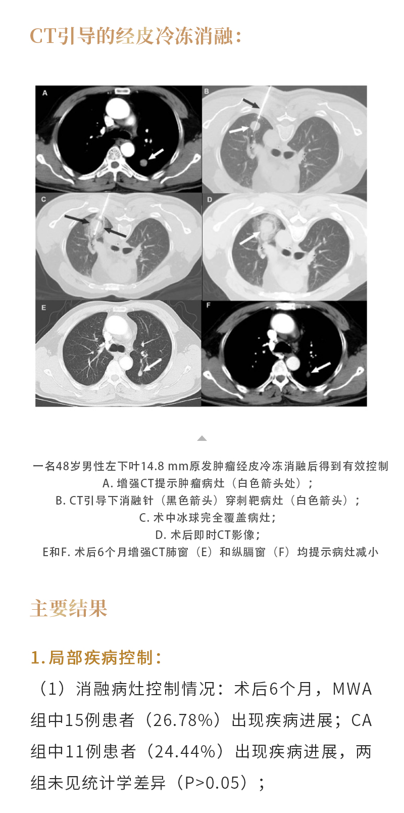 pvcs6z6mkVf6448O88UzfspBOB0wn4eR0uWECPiX