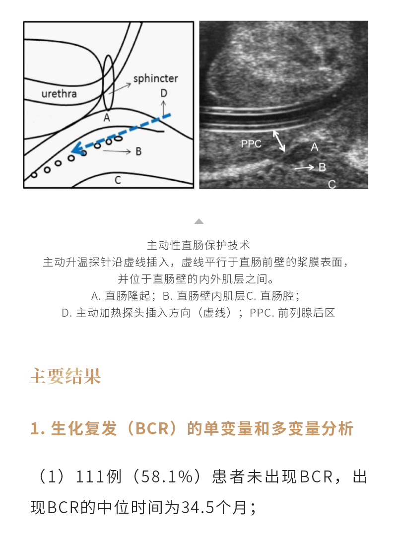 B0ycm5UNoP1mgxLu5jnaZOWVBbOzTZKvj49rudXD